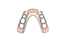 入れ歯があわない