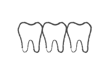 前歯の歯並びが気になる