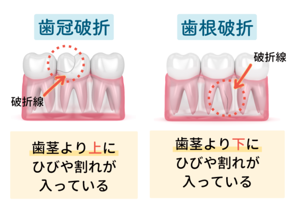 原因は何ですか?