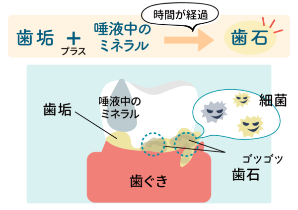 ココナッツオイルを使ったオイルプリング
