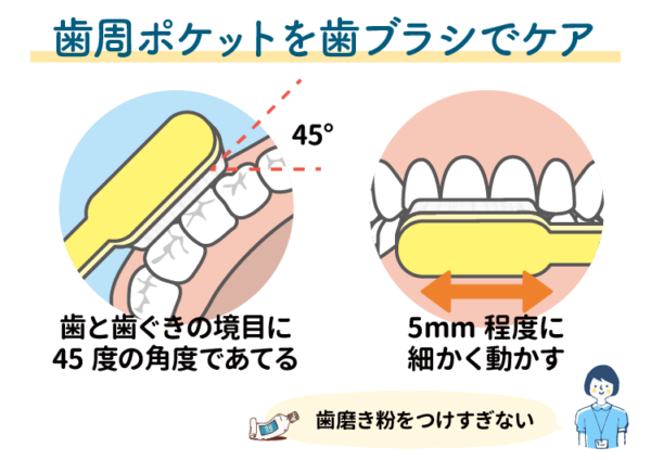 歯周ポケットを歯ブラシでケアする方法