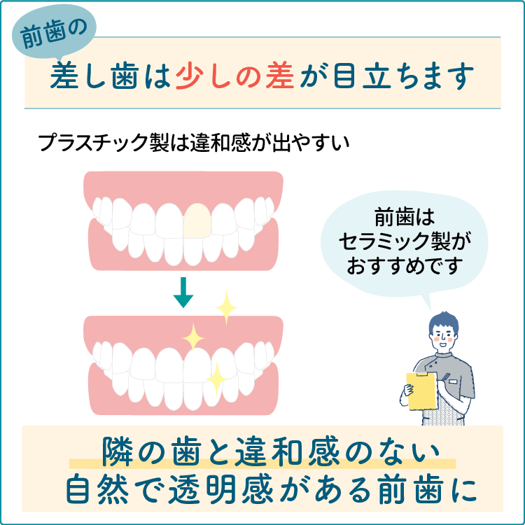歯の破折の治療方法