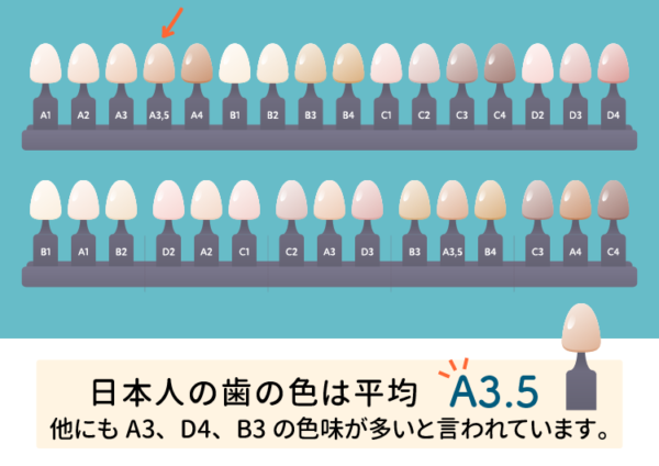 カラーシェード歯の色見本