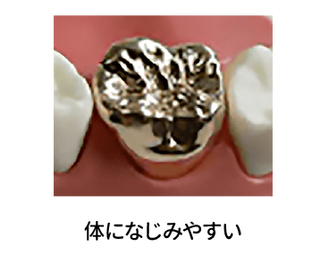 ゴールド