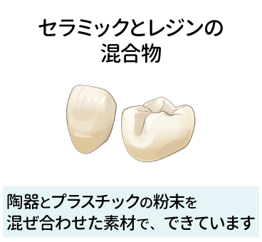 ハイブリッド