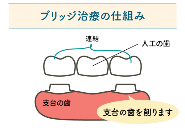 ブリッジの仕組み
