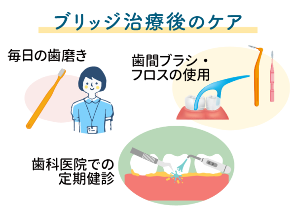 ブリッジでのケア