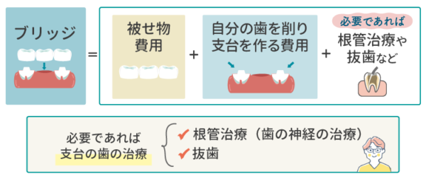 ブリッジの費用計算