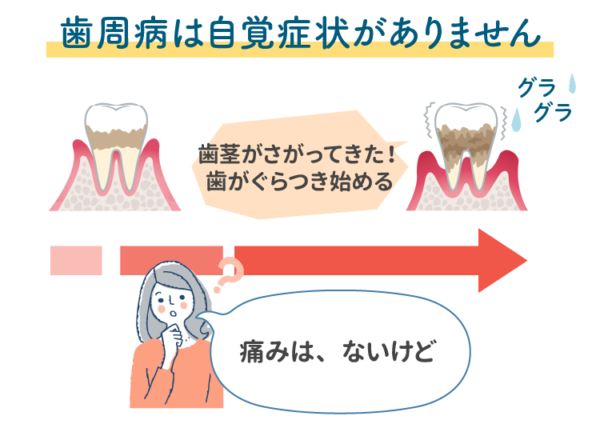歯周病は自覚症状がありません