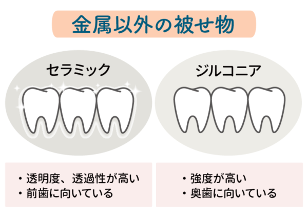 金属以外の被せ物