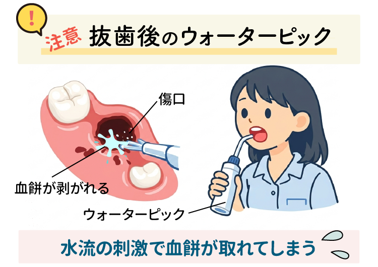 ウォーターピック使用の注意